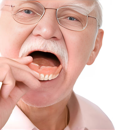 SureSmile™ Full Denture Solution – Easy Fit, Lasting Comfort